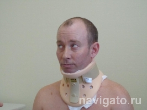 Резорбция грыжи межпозвонкового. Операция на шейном позвоночнике. Шейная грыжа после операции. Шейная грыжа после операции. Шейная грыжа после операции.