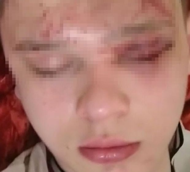 Школьников, избитых сверстниками в Новосибирске, госпитализировали