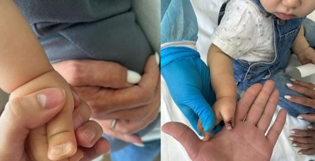 В НИИТО помогли годовалому ребенку