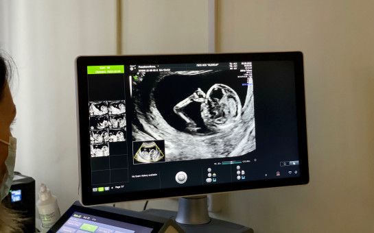 На диспансеризации новосибирцы смогут проверить репродуктивное здоровье