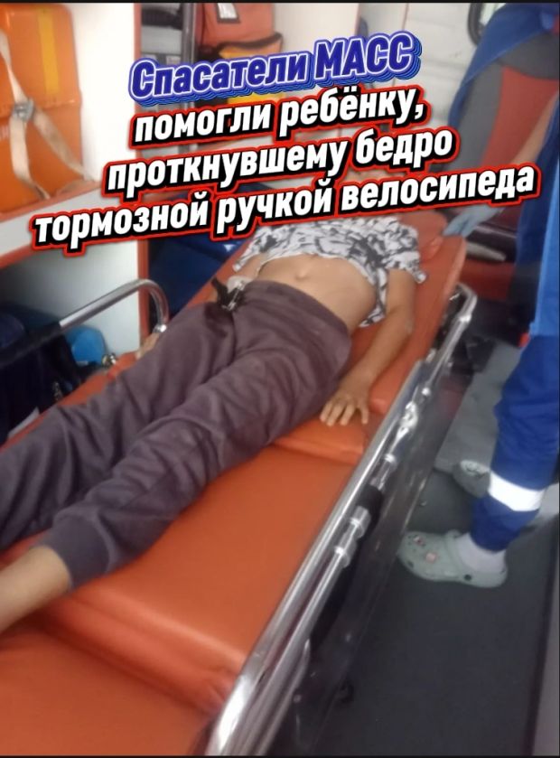 Подросток получил тяжелую травму из-за велосипеда